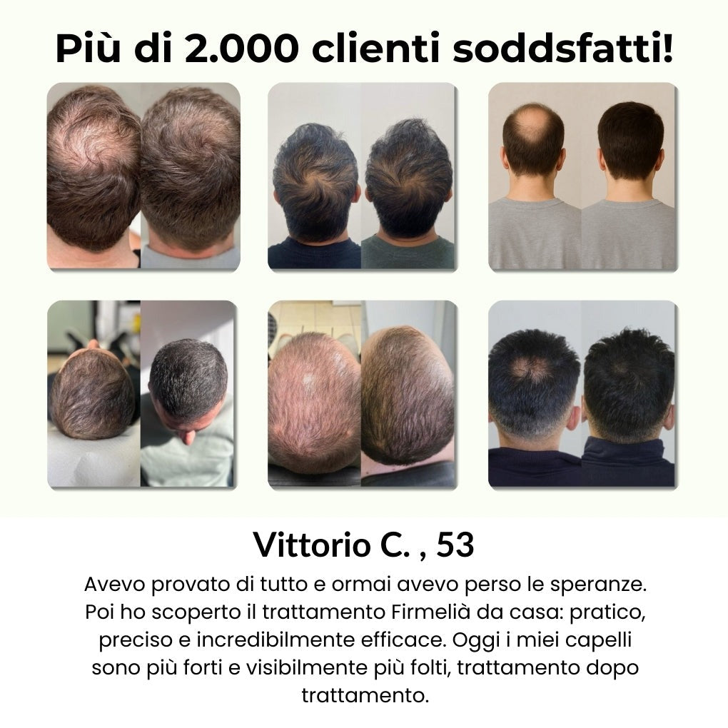 Firmelia – Sistema di microinfusione Firmelià® per la ricrescita dei capelli